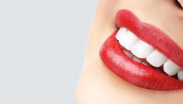 Blanqueamiento dental, ¿qué es, cuándo es recomendable y qué resultados se obtienen?